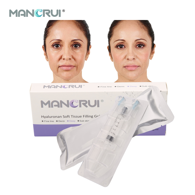 Deep 5ml Hyaluronic Acid Filler for Deep wrinkles and lines, Nasolabial folds, Marionette lines, Forehead wrinkles, Chin contour, Nose shape（Certified by CE and FDA.）