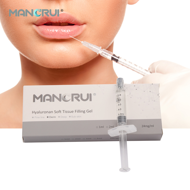 Cross Linked Hyaluronic Acid Filler Derm 5ml， 1 piece can address lip plumping and mid-layer facial wrinkles