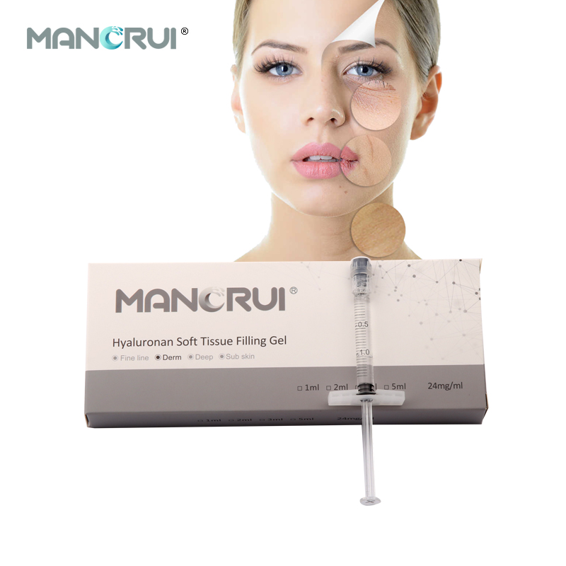 Derm 1ml Cross Linked Hyaluronic Acid Filler Lip Filler, Natural lip plumping effect.,  for Marionette Line, Glabella lines (frown lines) , Mid-depth smile lines,Moderate nasolabial folds,  Cheek contour wrinkles