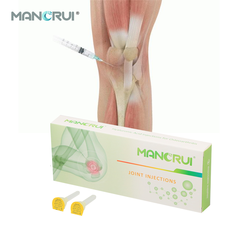 New products 3ml Non-crosslinked hyaluronic acid knee joint injection for osteoarthritis（Certified by CE and FDA.）