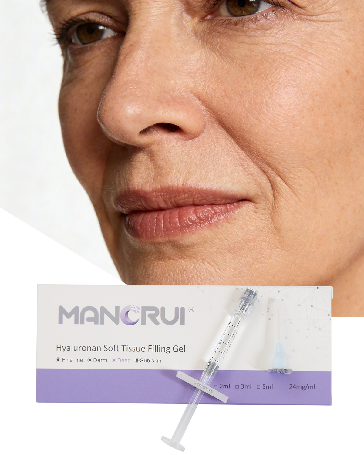 Deep 1ml Cross Linked Hyaluronic Acid Filler for Nose Shape, Chin Contour & Wrinkle Removal – Nasolabial, Marionette, Forehead Lines, Structural volume loss lines