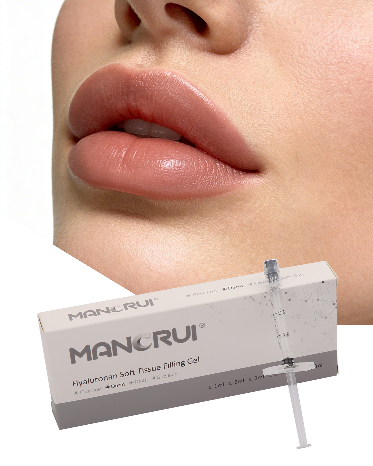 Derm 1ml Cross Linked Hyaluronic Acid Filler Lip Filler, Natural lip plumping effect.,  for Marionette Line, Glabella lines (frown lines) , Mid-depth smile lines,Moderate nasolabial folds,  Cheek contour wrinkles