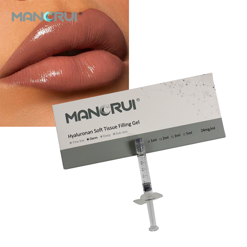 Cross Linked Hyaluronic Acid Filler Derm 2ml Lip Filler, Normal lip plumping effect., for Marionette Line, Glabella lines (frown lines) , Mid-depth smile lines