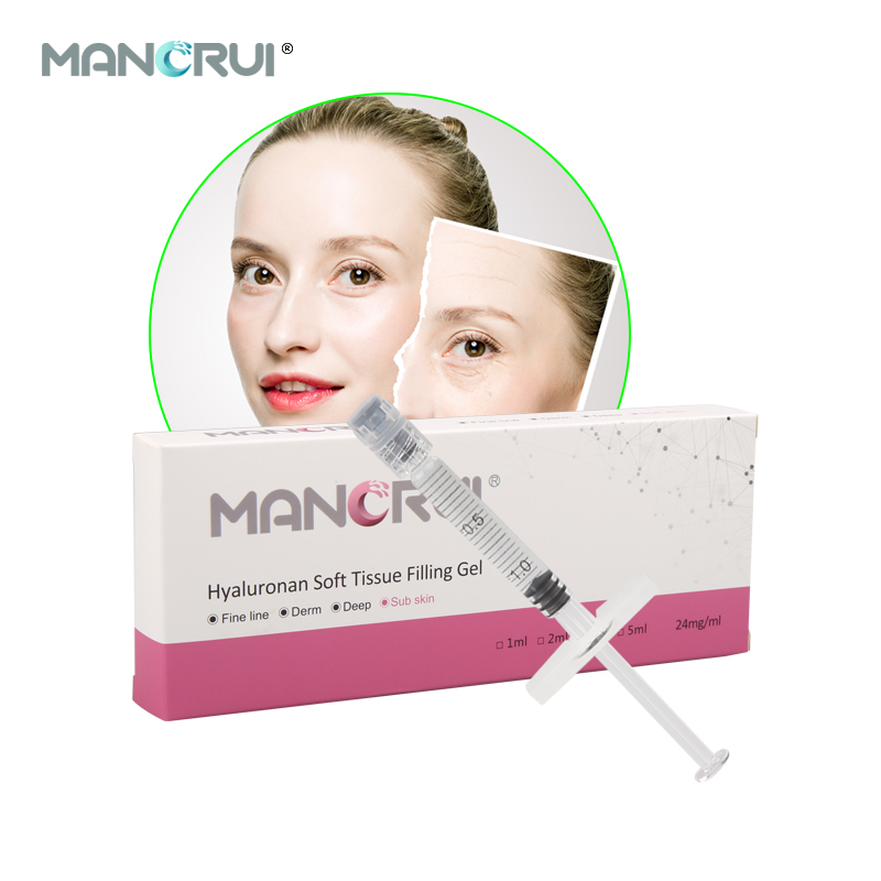 Cross-linked Hyaluronic Acid Filler Subskin 1ml chin FIller, each cheek need 1ml ( There's a slight effect，not very noticeable)（Certified by CE and FDA.）