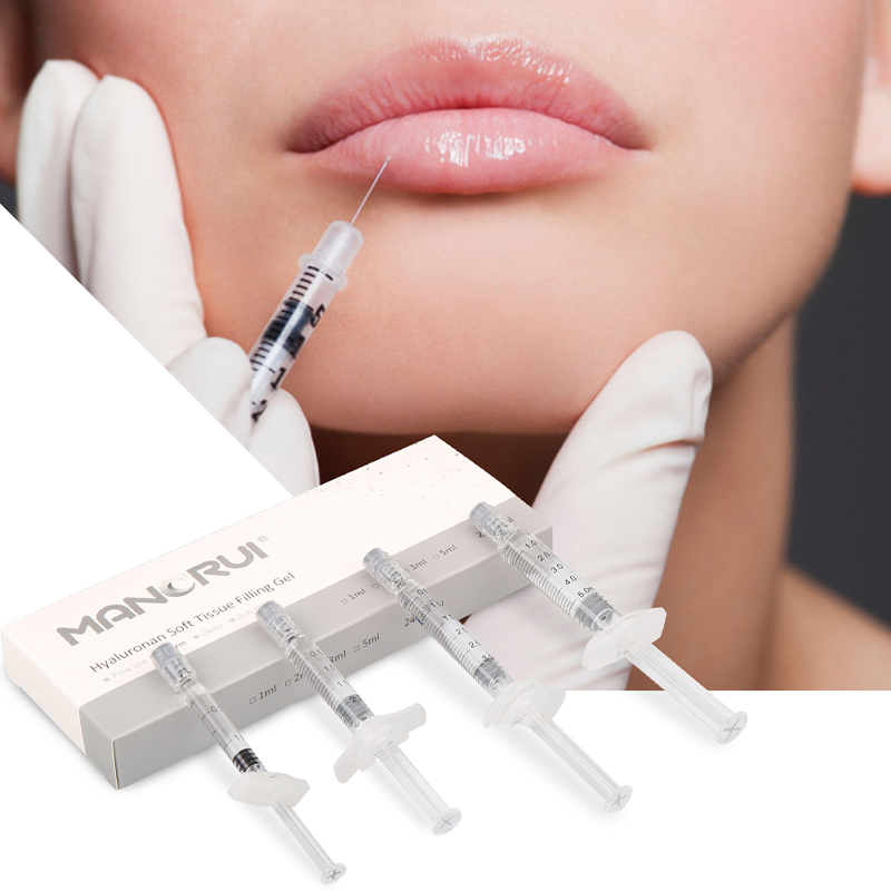 Cross Linked Hyaluronic Acid Filler Derm 2ml Lip Filler, Normal lip plumping effect., for Marionette Line, Glabella lines (frown lines) , Mid-depth smile lines